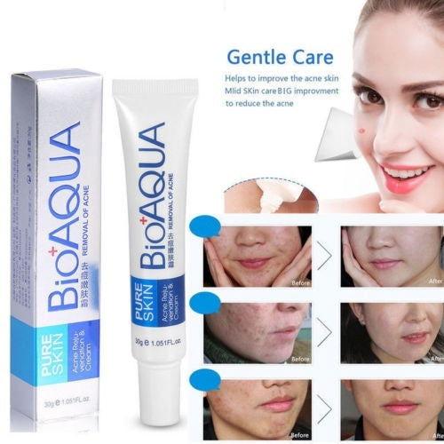 BIOAQUA Pure Skin Acne Removal Anti-Wrinkle Treatment Cream - Elite Cosmetics