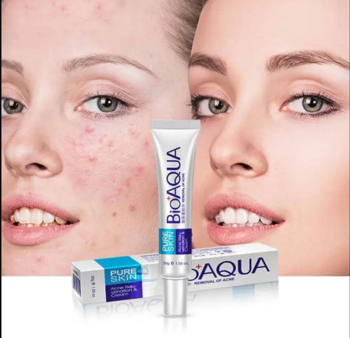 BIOAQUA Pure Skin Acne Removal Anti-Wrinkle Treatment Cream - Elite Cosmetics