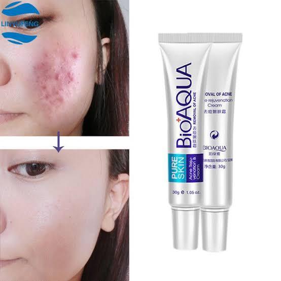 BIOAQUA Pure Skin Acne Removal Anti-Wrinkle Treatment Cream - Elite Cosmetics