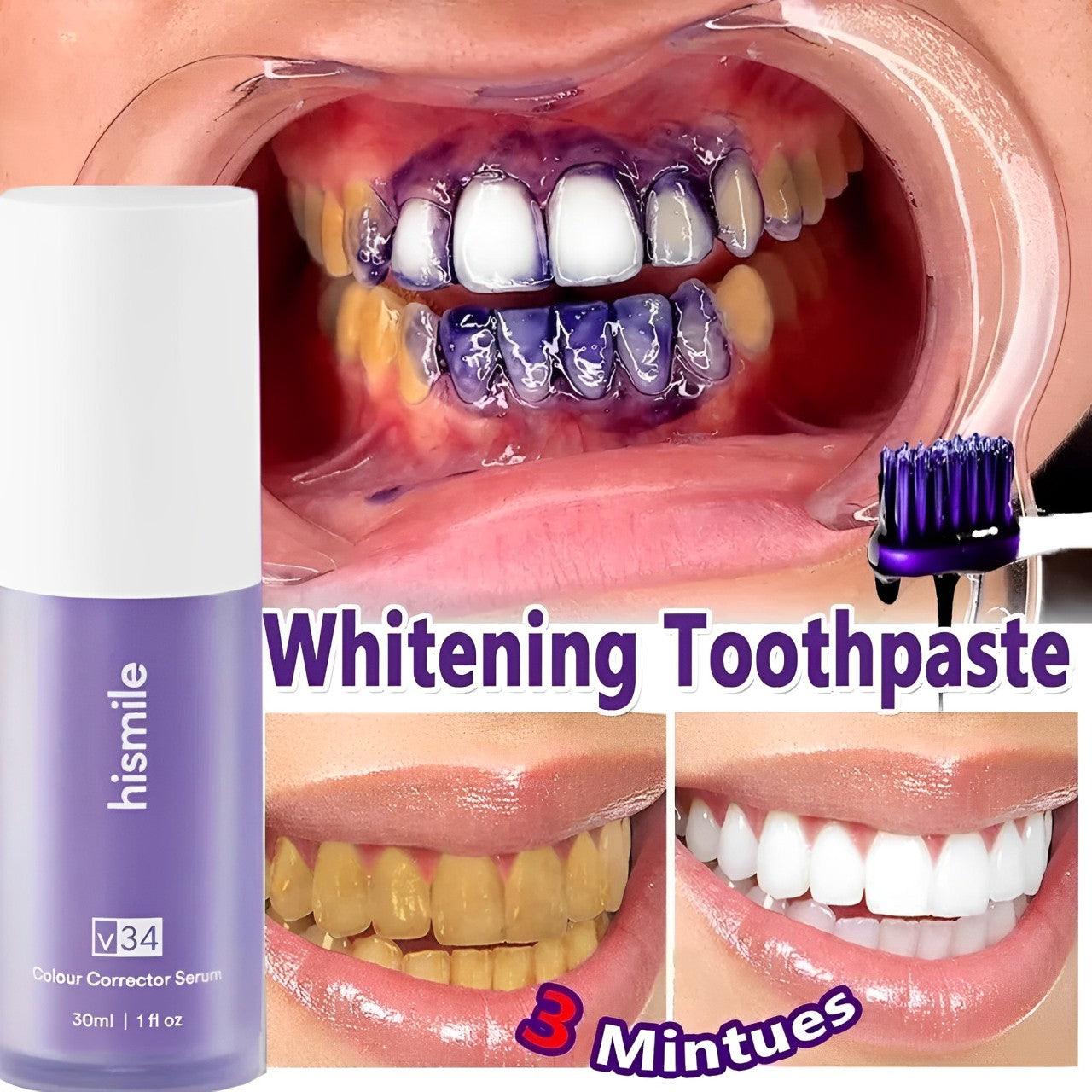 Hi Smile Color Corrector Serum – Brighten & Whiten Your Teeth Safely - Elite Cosmetics