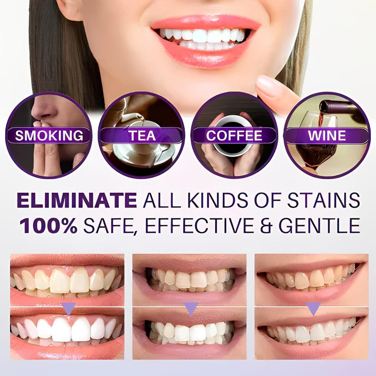 Hi Smile Color Corrector Serum – Brighten & Whiten Your Teeth Safely - Elite Cosmetics