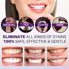 Hi Smile Color Corrector Serum – Brighten & Whiten Your Teeth Safely - Elite Cosmetics